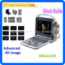 MSLCU28i Новый стиль и технология 3D 4D Color Doppler Ультразвуковой сканер Портативная ультразвуковая машина с дешевой ценой